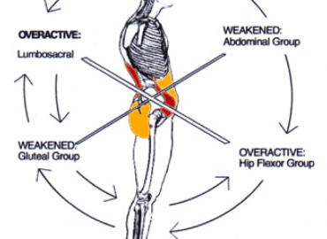 Lower Crossed Posture